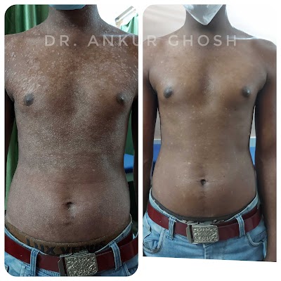 Dr. Ankur Ghosh
