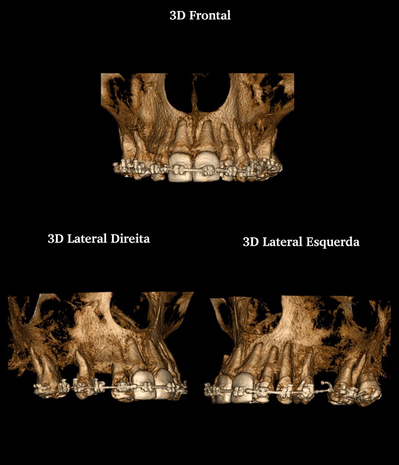 Radiologia Odonto imagem - Centro - foto 5