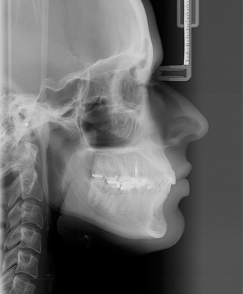 Radiologia Odonto imagem - Centro - foto 4