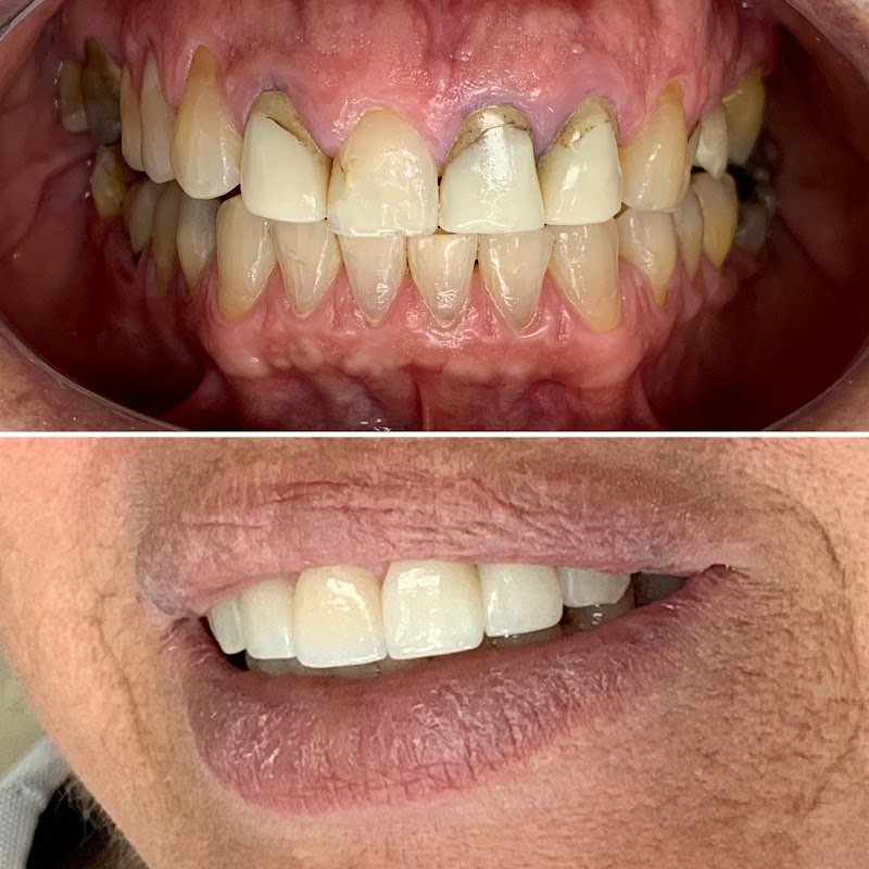 Dra. Renata Soares - Protesista e Especialista em Reabilitação Oral - foto 2