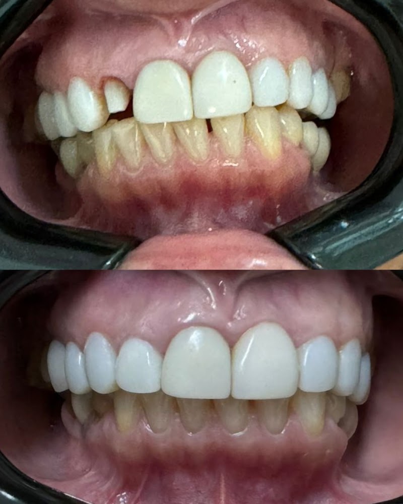 Dra. Rosália Cavaliere | Dentista | Alinhador invisivel | Odontologia Integrada | Duque de Caxias - foto 2