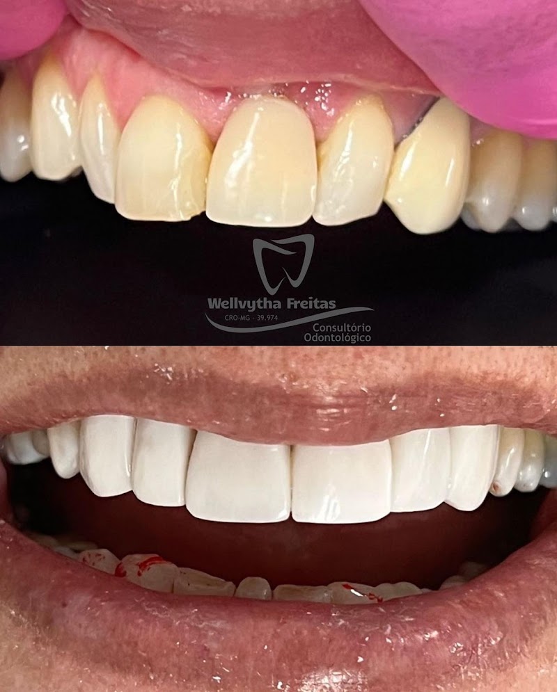 Dentista Dra. Wellvytha Freitas - Consultório Odontológico - foto 3