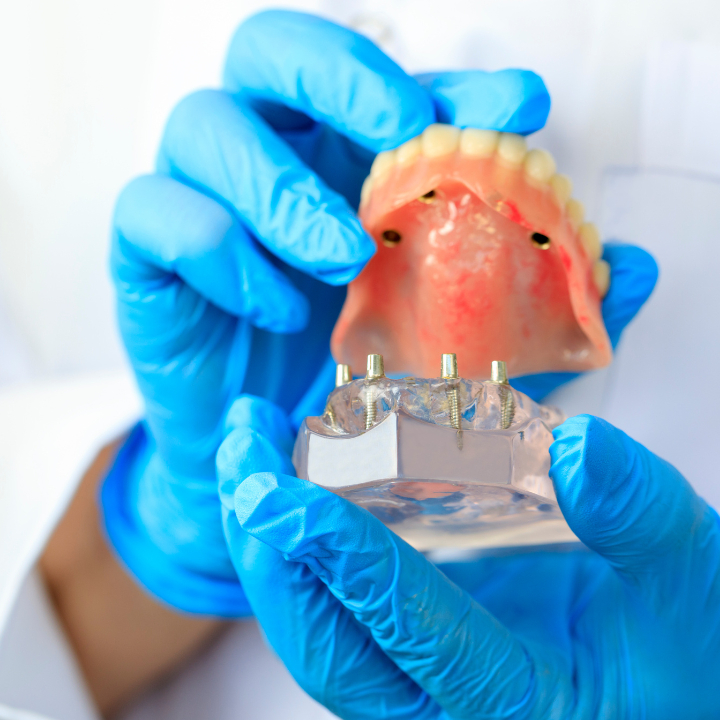 Dentista Dr Fausto Queiroz I Implante Dentário em Salvador - foto 5