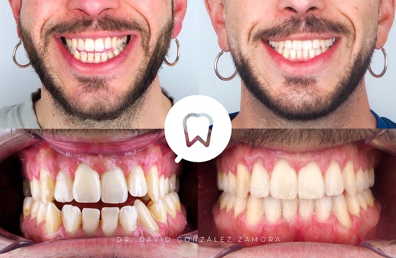 Ortodoncia Madrid Centro