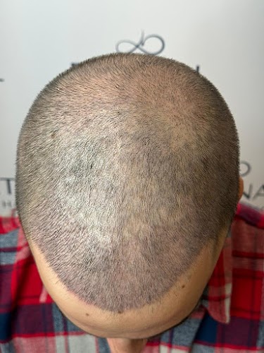 Eternal Hair Clinic logo