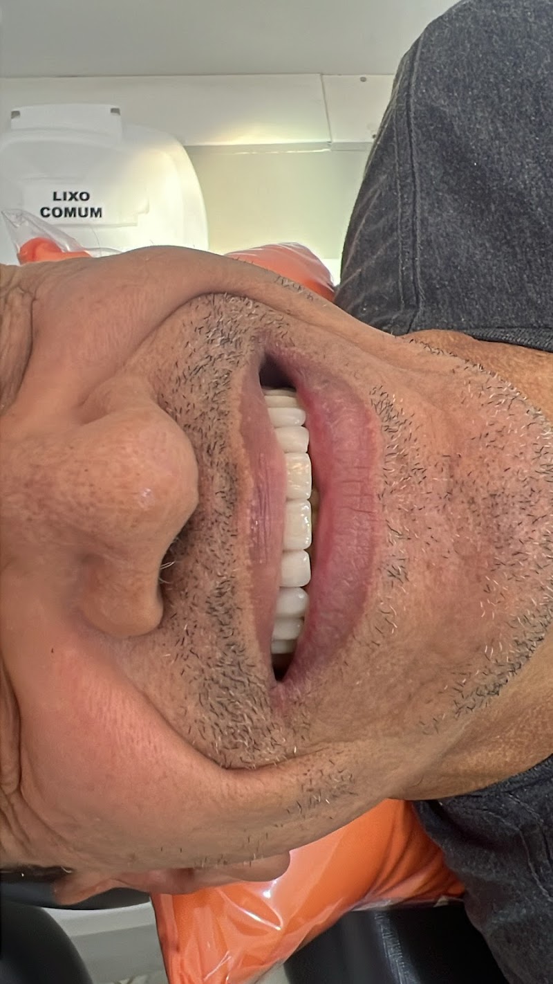 Dentista Manaus - Dra Irla Thaís - Prótese Dentária