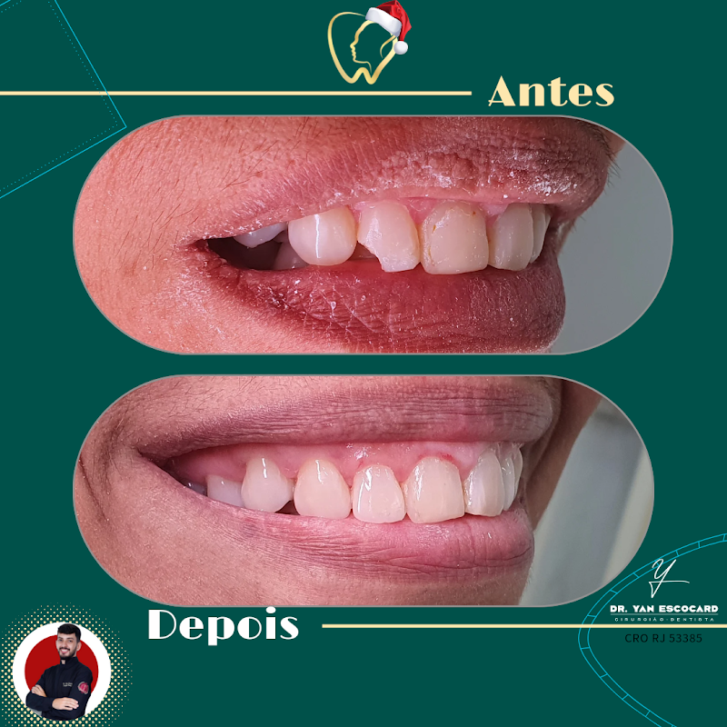 Inove clínica odontológica I Campos dos Goytacazes | Não atendemos plano. - foto 4