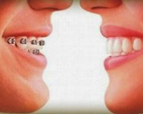 ++Odontoclinica Pampulha - Implantes Dentarios - Aparelhos , odontopediatria. - foto 2