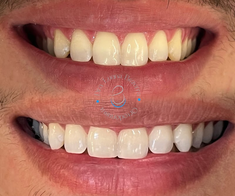 Dra. Luana Bezerra, Invisalign - foto 2