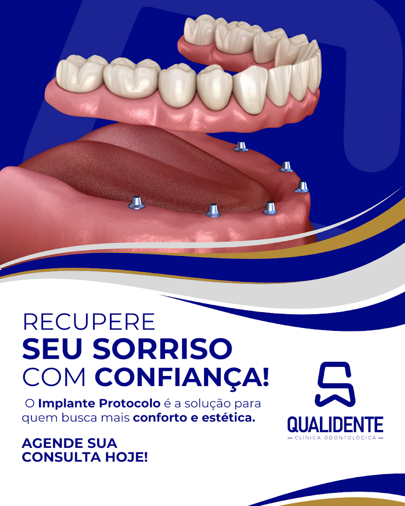 Qualidente - Implantes em Angra dos Reis