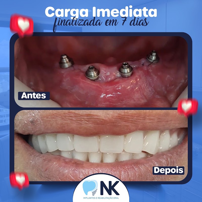 NK Implantes - Tijuca - foto 2