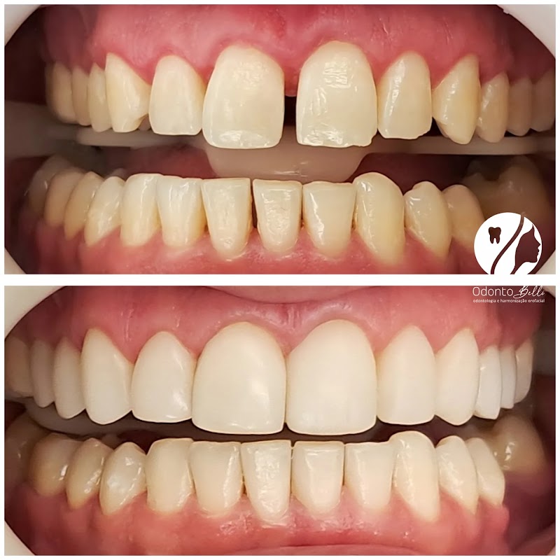 Odontologia Ecoville Estética Facial e Dental - foto 4