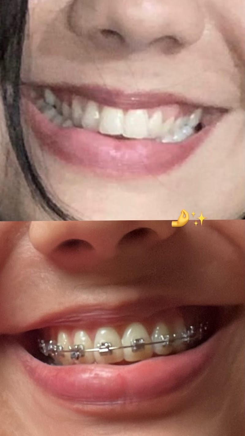 Dra. Louise Azevedo - Ortodontia (Aparelho fixo e alinhador) e Bucomaxilofacial - foto 2