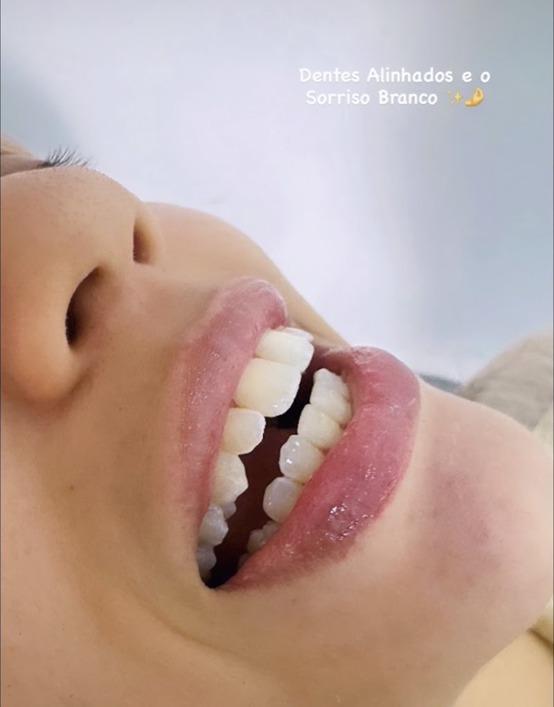 Dra. Louise Azevedo - Ortodontia (Aparelho fixo e alinhador) e Bucomaxilofacial - foto 3