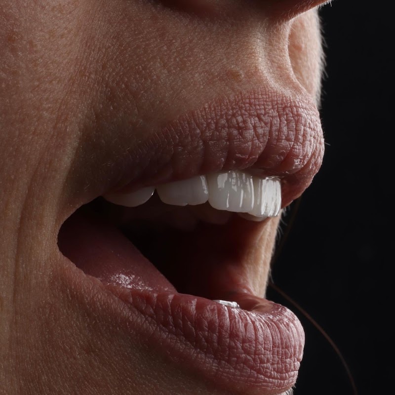 Ortoestética Odontologia Invisalign - foto 3