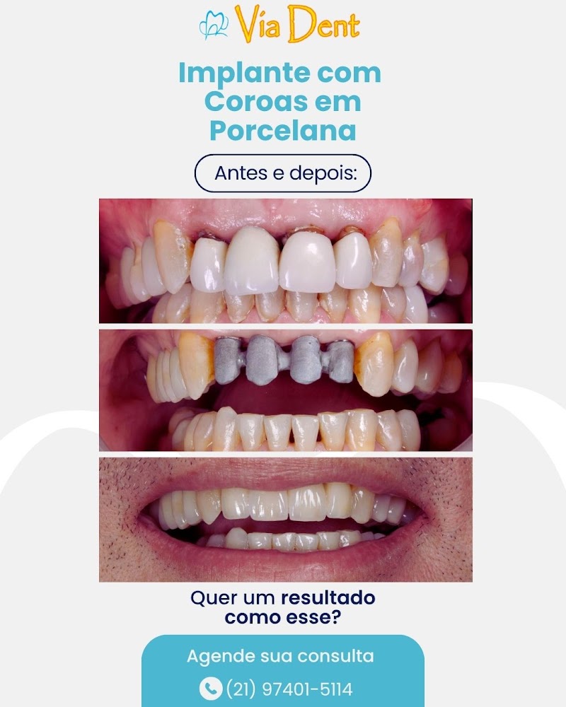 Via Dent Alcântara Implante Dentário - foto 2