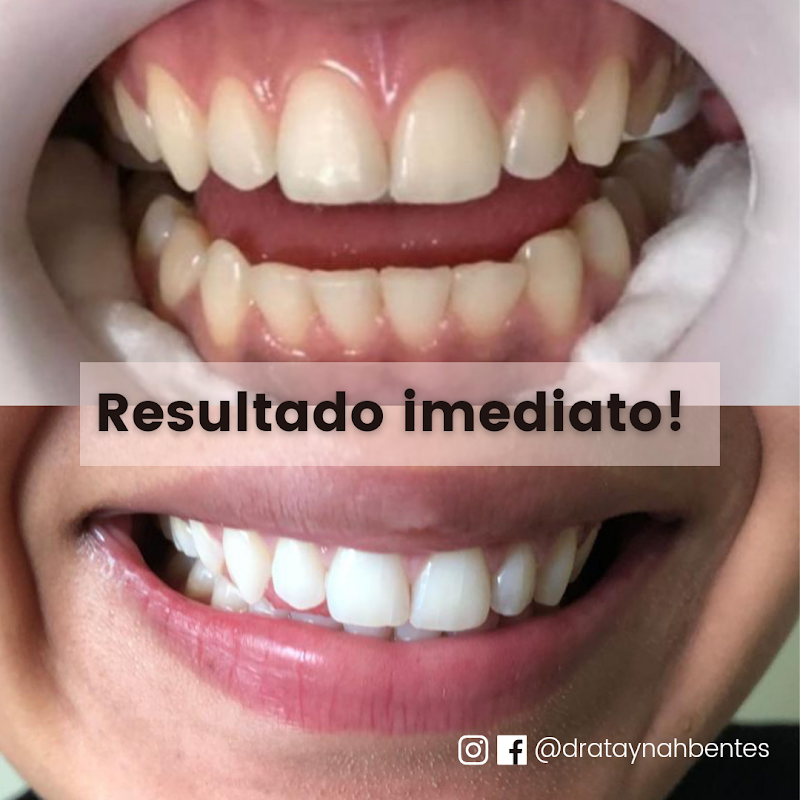 Dentista Dra Taynah Bentes - foto 4