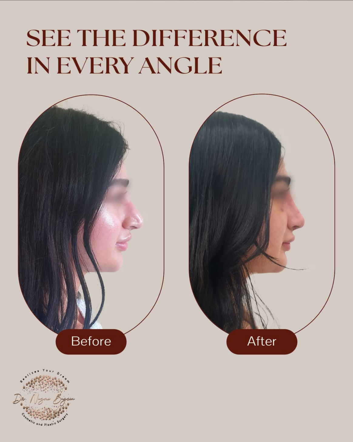Dr. Nazmi Baycin - Plastic Surgeon | Dubai 5