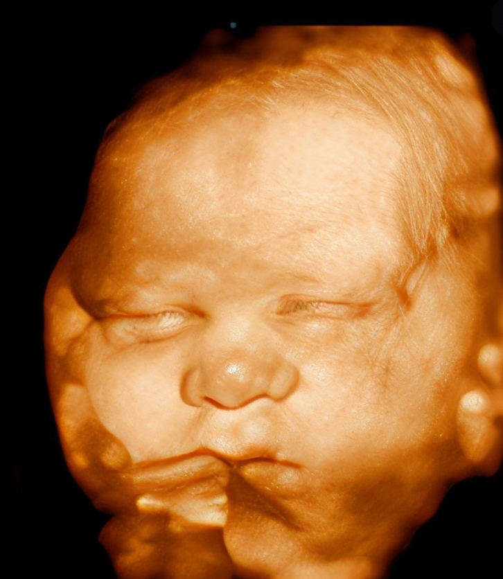 3D/4D Mini Baby Mae Ultrasound Image