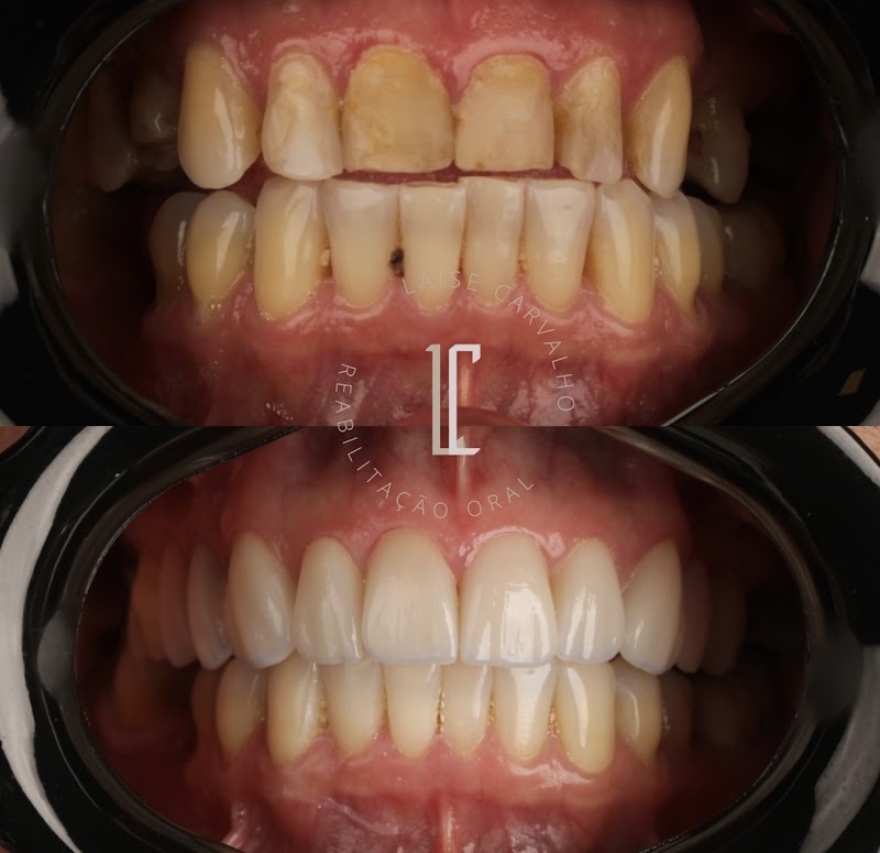 Dra. Laíse Carvalho – Dentista Jacarepaguá - foto 2