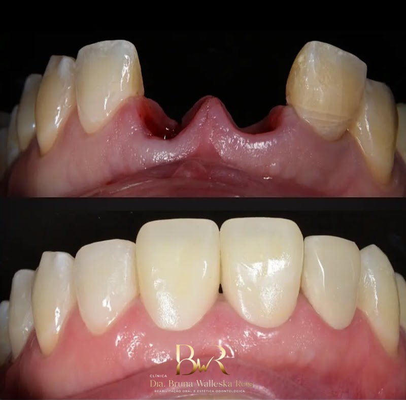 DENTISTA 24 HORAS | URGÊNCIA E ESTÉTICA | BWR ODONTOLOGIA - foto 4