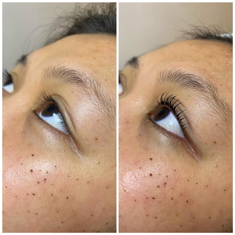 BM Aesthetix - Aesthetic Clinic in Taguig