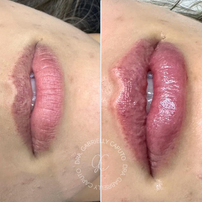 Dra. Gabrielly Caputo - foto 4