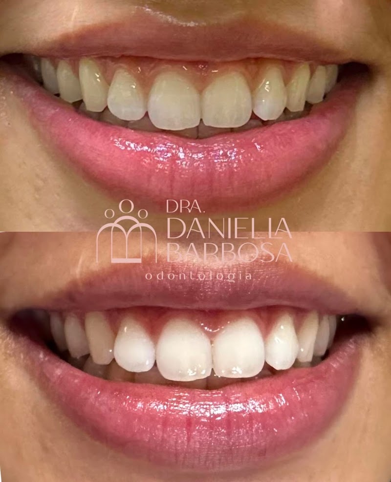 Dra. Daniella Barbosa - Dentista | Clareamento Dental - Clínica Barbosa e Sousa Odontologia - foto 2