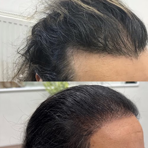 Este hair medical USA logo