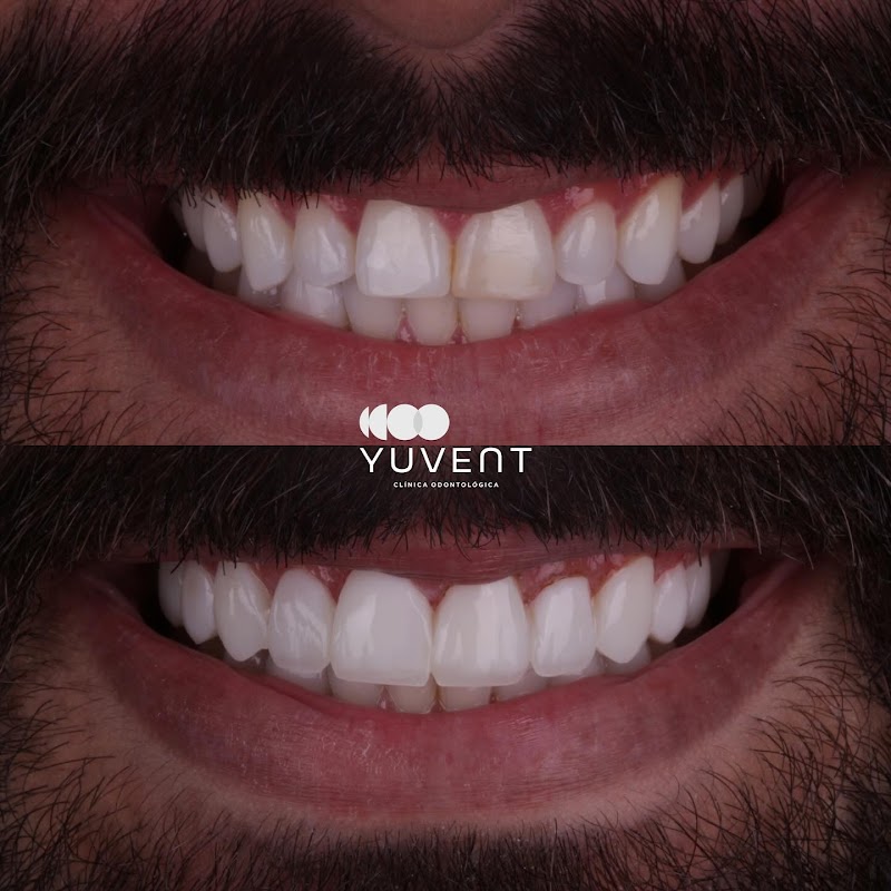 Dra. Luiza Furtado | Lentes em Resina Volta Redonda - foto 3