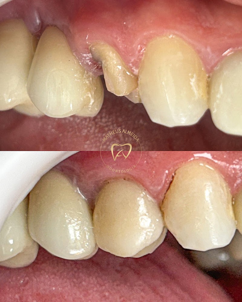 Dr. Matheus Almeida | Dentista em Volta Redonda - foto 5
