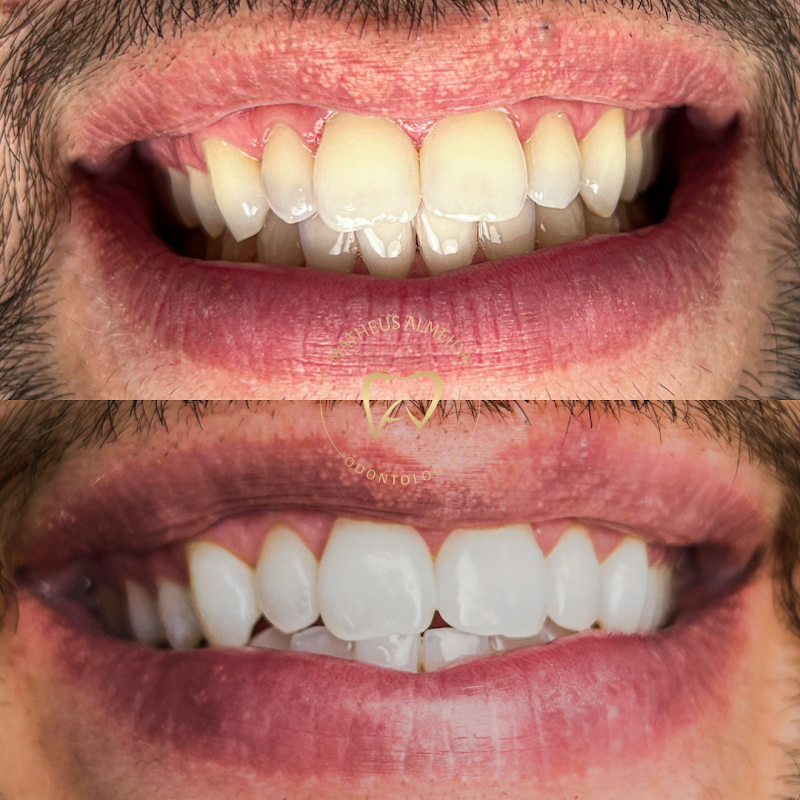 Dr. Matheus Almeida | Dentista em Volta Redonda - foto 2