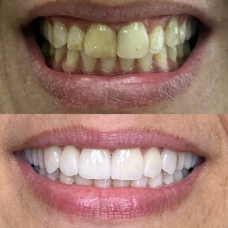 Elisângela Marcondes • Odontologia Especializada • Cirurgiã Dentista - foto 2