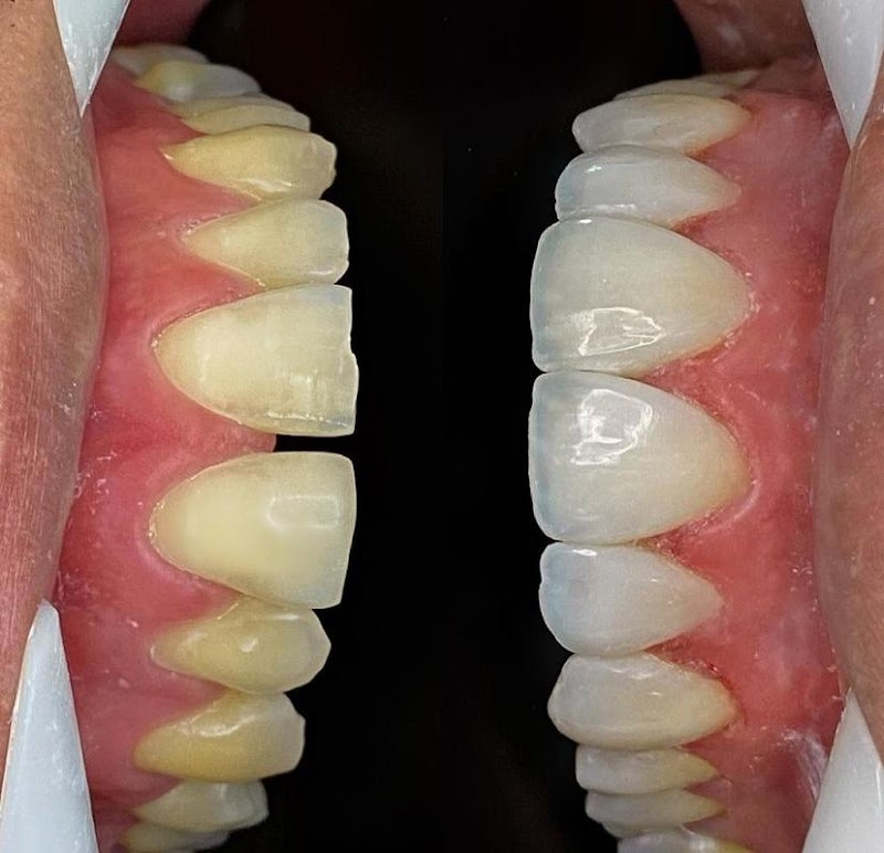 Implante Dental Campinas - foto 2