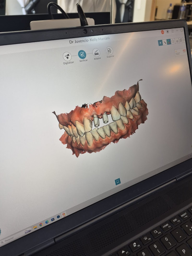 DENTISTA AVENIDA PAULISTA / DOR DE DENTE - DR JUVÊNCIO NETO / ENDODONTIA / INVISALIGN. - foto 4