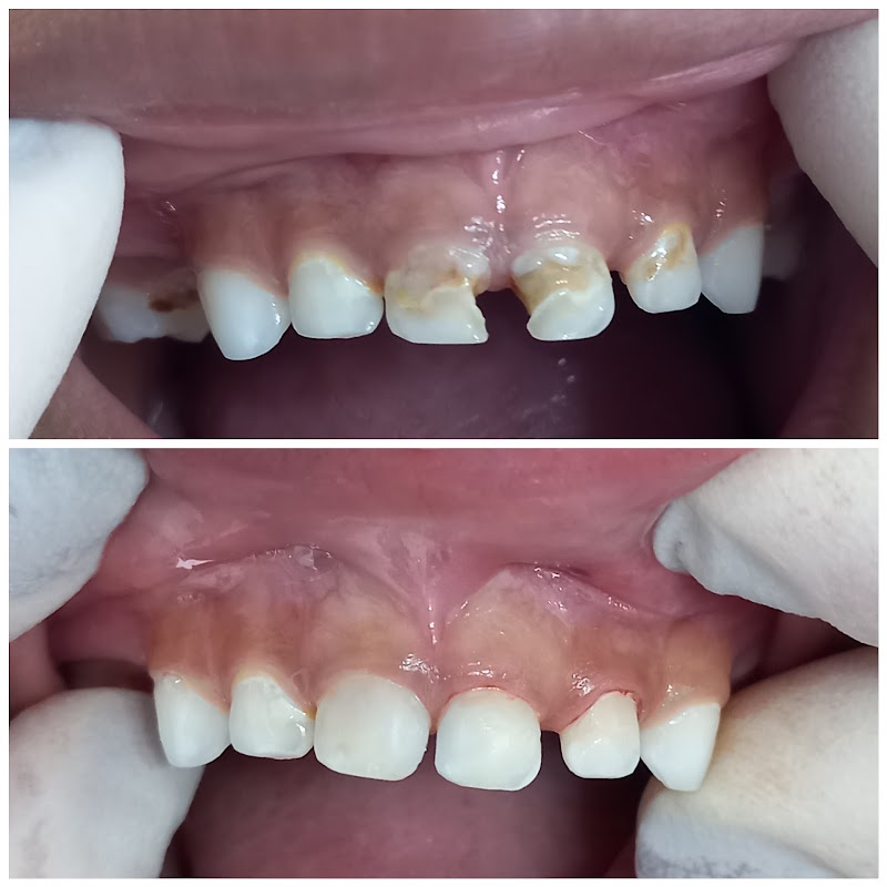 Odontopediatria Dra Paula Carpini Marinuzz - foto 4