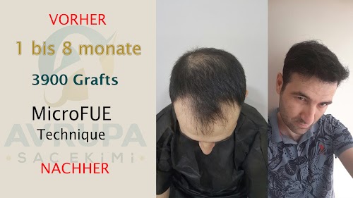 Avrupa Sac Ekimi - Haartransplantation logo