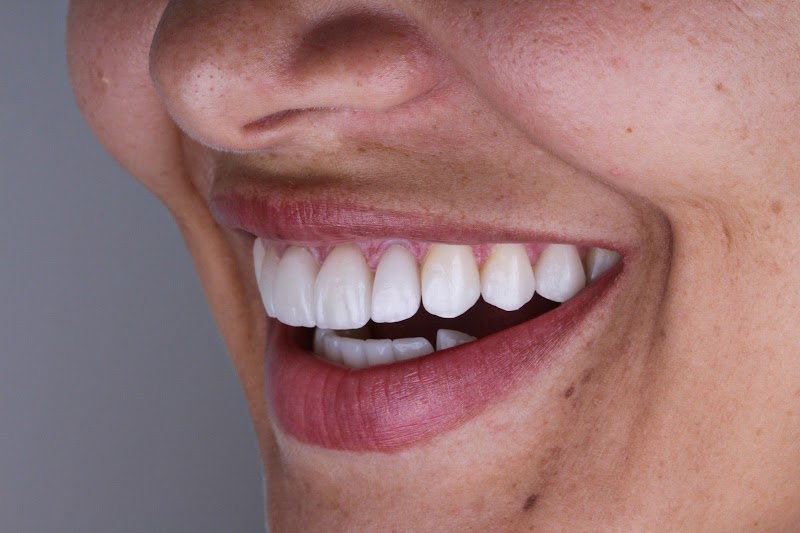 ESTHETIC IMPLANTES ODONTOLOGIA - foto 5