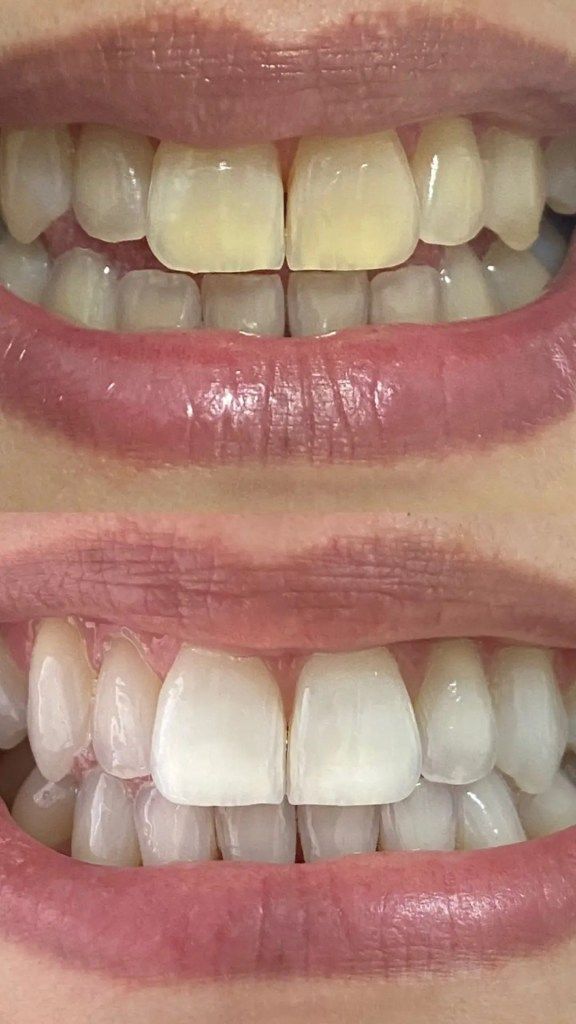 Dr. Maurício Guidolin - Invisalign Porto Alegre - foto 5