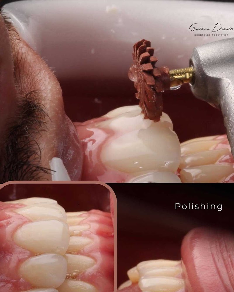 Dr. Gustavo Duarte - Especialista em Lentes e Facetas de Resina | Recife - PE - foto 3