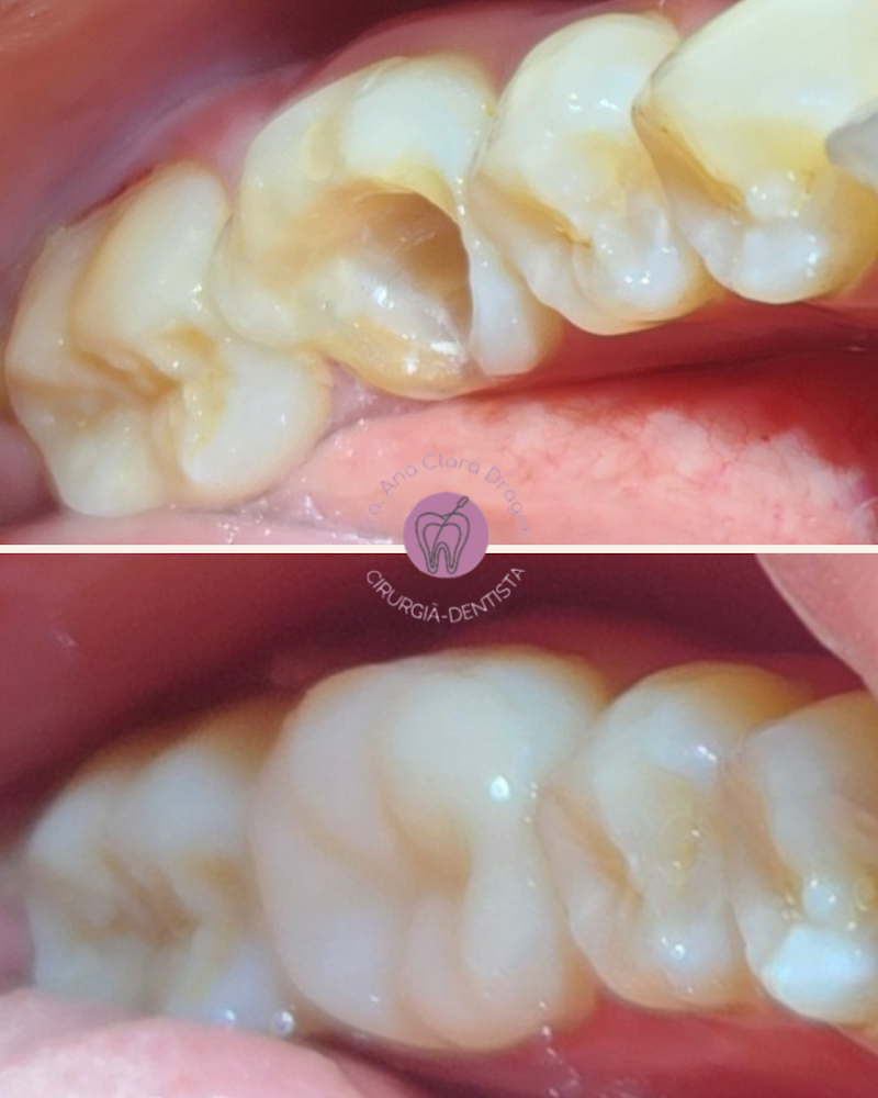 Endodontista - Dra. Ana Clara Dragon