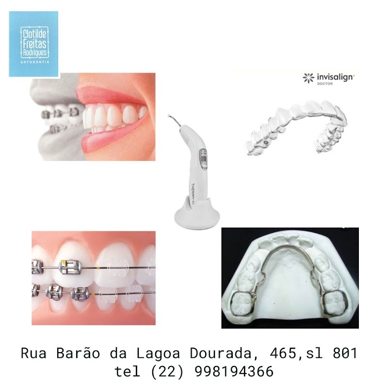 Ortodontia e Ortopedia dos Maxilares