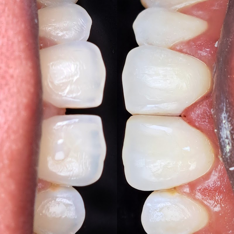 Dra Stephanie Yone - Dentista | Bruxismo | Tratamento de canal | Alinhadores Invisíveis | Recreio dos Bandeirantes - foto 3