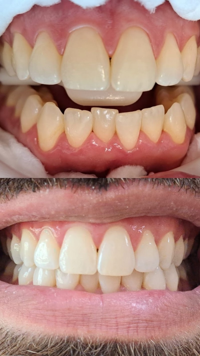 Dra Stephanie Yone - Dentista | Bruxismo | Tratamento de canal | Alinhadores Invisíveis | Recreio dos Bandeirantes - foto 2