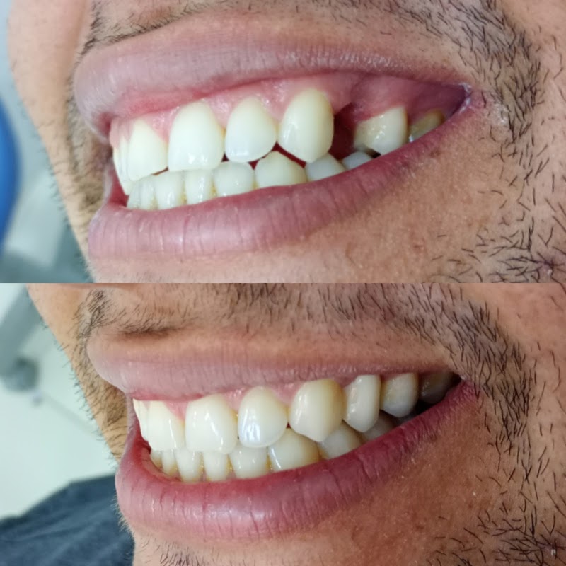 Dr Anderson Gurgel - Reabilitação Oral e Estética