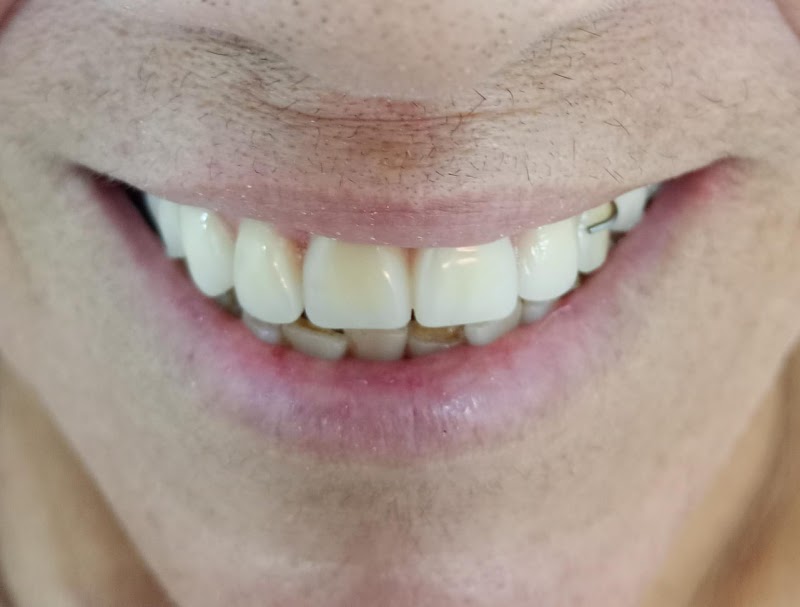 Dr Anderson Gurgel - Reabilitação Oral e Estética - foto 4