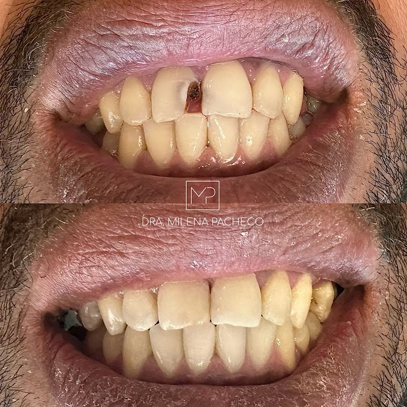 Dra. Milena Pacheco - Dentista Curitiba - foto 4