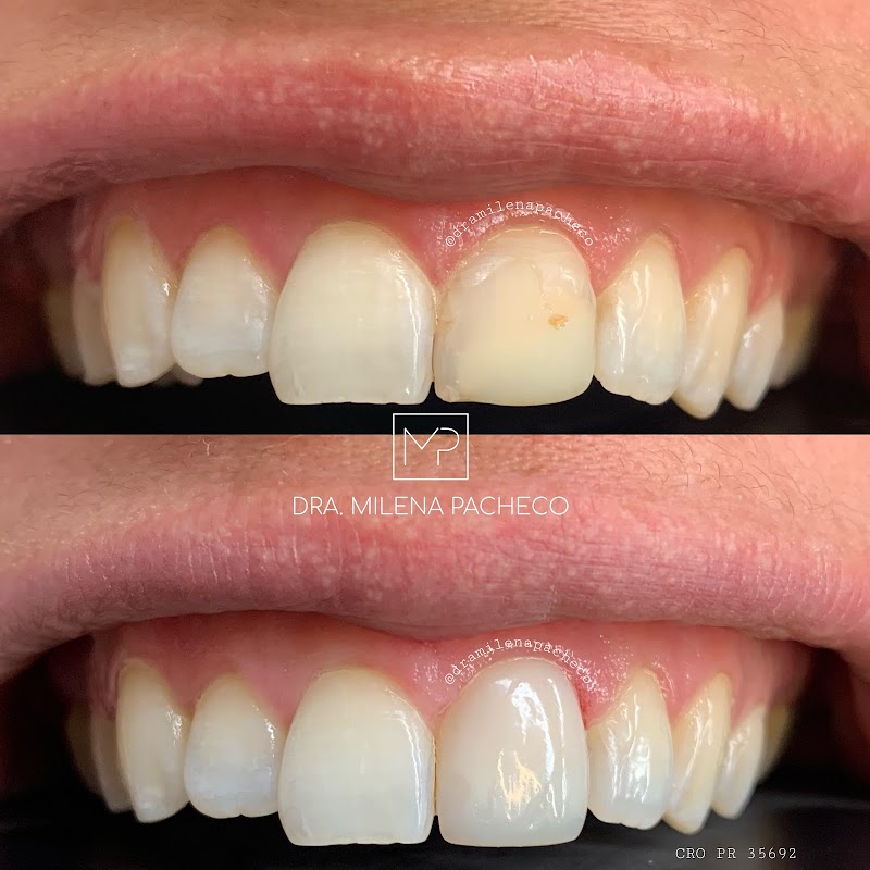 Dra. Milena Pacheco - Dentista Curitiba - foto 5