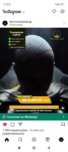 Hair Transplante Transplante capilar na zona sul de São Paulo logo