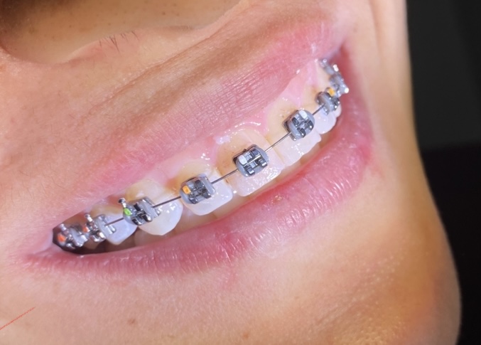 Dra Sabrina Daniele | Ortodontista | Invisalign em Ribeirão Preto - foto 2